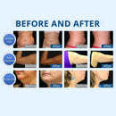 Shape Tactics - 2-in-1 Advanced Cryolipolysis Fat Freezing Vacuum Body Sculpting Machine for Double Chin Fat Removal and Slimming
