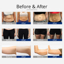 Shape Tactics 360° RF Ultrasonic Cavitation Vacuum for Body Slimming and Sculpting