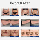 Shape Tactics 4-in-1 Body Slimming with Unoisetion Cavitation, RF, and EMS