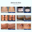 Shape Tactics 4-in-1 Cryolipolysis Cold Vacuum Cavitation RF Machine