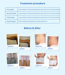 Shape Tactics 5-in-1 40K Cavitation Cryolipolysis 160nm Lipo Laser