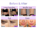 Shape Tactics 5-in-1 80K Cavitation Vacuum Therapy