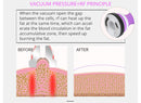 Shape Tactics 5-in-1 Body Slimming RF Cavitation Machine
