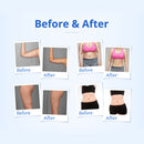 Shape Tactics 5-in-1 RF 40K Cavitation