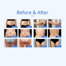 Shape Tactics 5-in-1 Unoisetion Ultrasonic RF Cavitation Weight Loss Machine