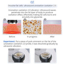 Shape Tactics 5-in-1 Unoisetion Ultrasonic RF Cavitation Weight Loss Machine