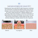 Shape Tactics 5-in-1 Unoisetion Ultrasonic RF Cavitation Weight Loss Machine