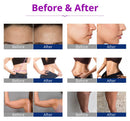 Shape Tactics 5-in-1 40K Cavitation RF Therapy Machine