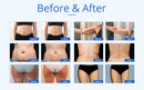 Shape Tactics 6-in-1 Advanced Unoisetion Cavitation 2.0 Vacuum RF Body Sculpting