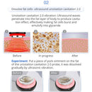 Shape Tactics - 8 in 1 Microcurrent RF Cavitation Laser Machine