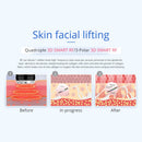 Shape Tactics - 8 in 1 Microcurrent RF Cavitation Laser Machine