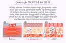 Shape Tactics - 9-in-1 Lipo Microcurrent Photon Ultrasonic Cavitation