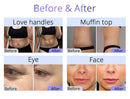 Shape Tactics 9-in-1 SMART RF 3D Cavitation Machine