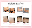 Shape Tactics - 9-in-1 Uniosetion Cavitation RF Vacuum Bio Photon Lipo Machine