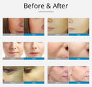 Shape Tactics Advanced 2-in-1 RF EMS Meso Skin Rejuvenation