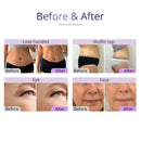 Shape Tactics Advanced 5-in-1 2.5 40K Cavitation Vacuum RF Technology