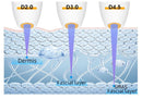 Shape Tactics - Advanced 7D HIFU Skin Rejuvenation Machine