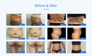 Shape Tactics - Advanced 8-in-1 Unoisetion Cavitation RF with LED Laser Pads