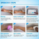 Shape Tactics Advanced 808nm Diode Laser Hair Removal