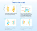 Shape Tactics - Advanced Stand-Up Fat Freezing Slimming Machine