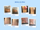 Shape Tactics - Advanced Stand-Up Fat Freezing Slimming Machine