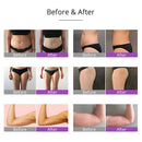 Shape Tactics Cavitation Vacuum RF 5MW Lipo Laser Slimming Device