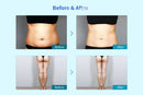 Shape Tactics Dual-Handle Cryolipolysis Fat Freezing Vacuum Slimming Device