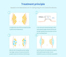 Shape Tactics Dual-Handle Cryolipolysis Fat Freezing Vacuum Slimming Device