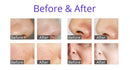 Shape Tactics - HydroGlow Pro: 6-in-1 Facial Beauty System