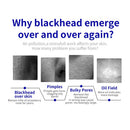Shape Tactics Microdermabrasion Vacuum Spray for Deep Facial Cleansing