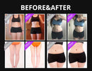 Shape Tactics Multifunctional 5-in-1 Ultrasonic Cavitation Vacuum RF Beauty Device