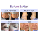 Shape Tactics Multifunctional Ultrasonic Cavitation Body Sculpting Device