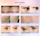 Shape Tactics - Photon LED Facial Care Micro Current Beauty Device