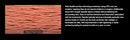 Shape Tactics Professional HIFU MPT MMFU Lifting System