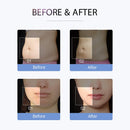 Shape Tactics S-Shape Cavitation RF Electroporation Vacuum Suction