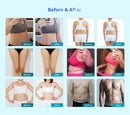 Shape Tactics - Triple-Handle Fat Freeze Vacuum Cellulite Machine