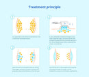 Shape Tactics - Triple-Handle Fat Freeze Vacuum Cellulite Machine
