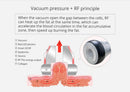 Shape Tactics - Unoisetion 40k Cavitation Ultrasound RF Multipolar Vacuum Photon
