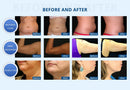 Máquina de adelgazamiento por vacío con criolipólisis y eliminación de papada Shape Tactics
