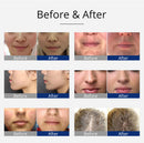 Shape Tactics - Violet 7-Electrode High Frequency Facial Device